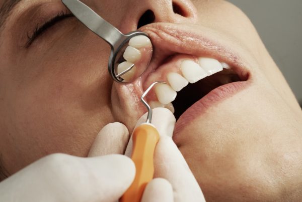 preporuka stomatoloških ordinacija za ugradnju zubnih implanta u beogradu